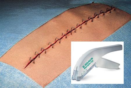 ky开元-意大利考虑出售黄金储备,为何黄金吸引力不减?(图2) ky开元集团官网入口